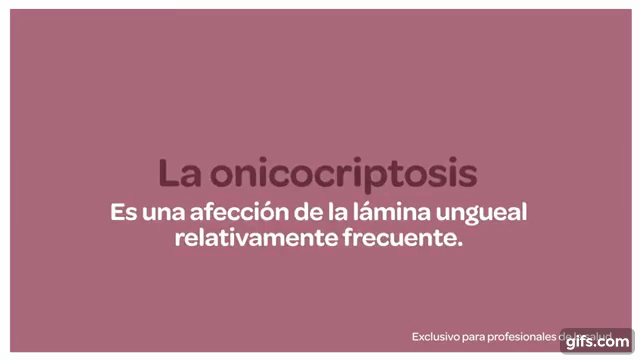 Onicocriptosis en niños