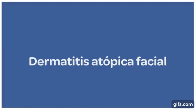 Dermatitis atópica facial